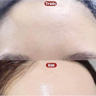 👉🏻𝐑𝐞𝐯𝐢𝐞𝐰 𝐊𝐞𝐦 𝐝𝐮̛𝐨̛̃𝐧𝐠 𝐚̂̉𝐦- 𝐤𝐢𝐞̂̀𝐦 𝐝𝐚̂̀𝐮 𝐅𝐥𝐨𝐬𝐥𝐞𝐤