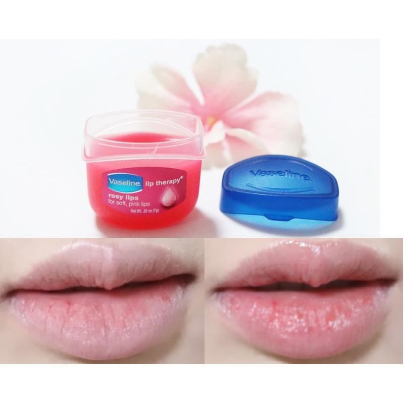 [ Hàng Auth] Son Dưỡng Môi Vaseline Lip Therapy 7g - | BigBuy360 - bigbuy360.vn