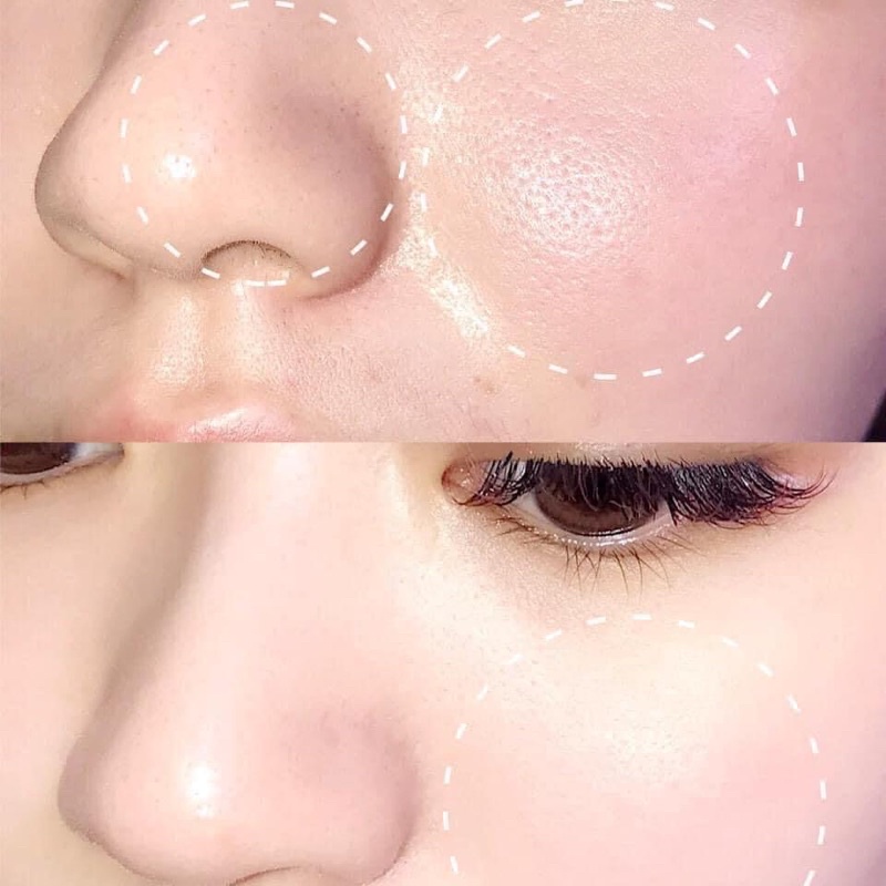 TONER BHAA | BigBuy360 - bigbuy360.vn