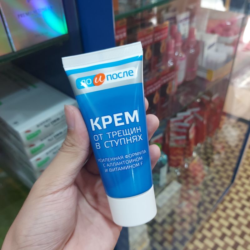 KEM NỨT GÓT CHÂN KPEM _ KEM NỨT GÓT CHÂN NGA