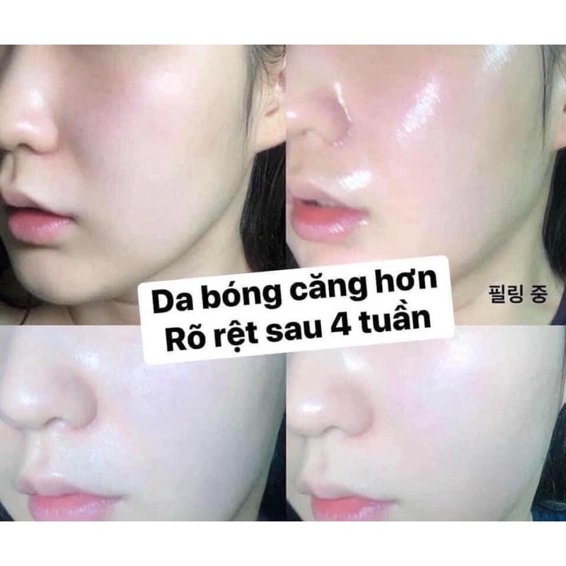 1 vỉ 2ml peel da CNP peel tái tạo da chuyên sâu CNP ngừa mụn dưỡng trắng căng bóng da mờ thâm nám 2ml