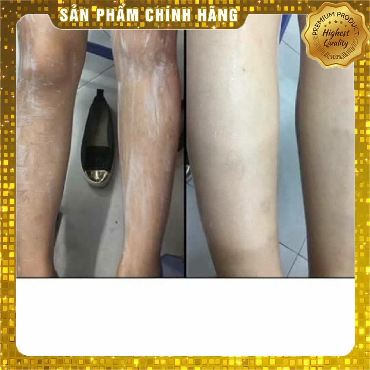 Kem tẩy lông Balea Đức