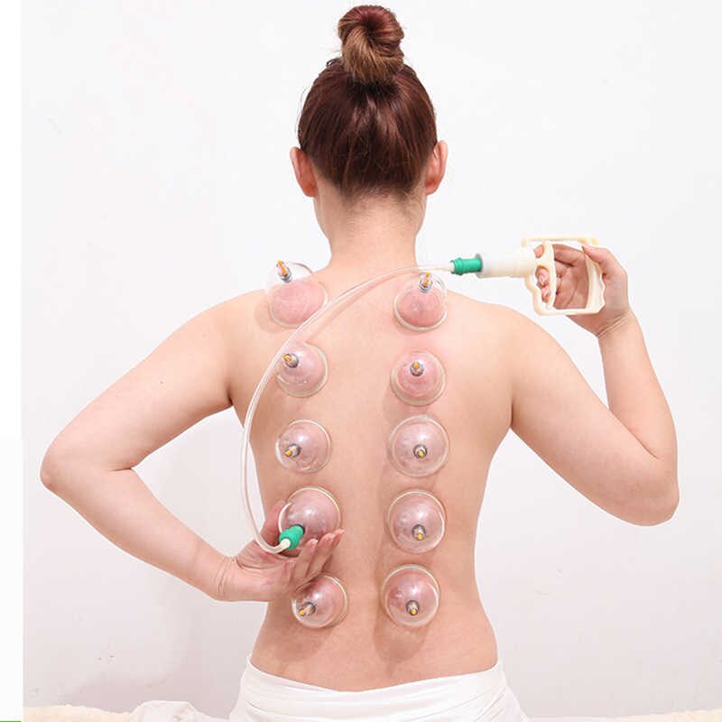 Bộ Giác Hơi KAW Không Dùng Lửa Cao Cấp 24 Phụ Kiện, Hút Chân Không, An Toàn Sức Khỏe