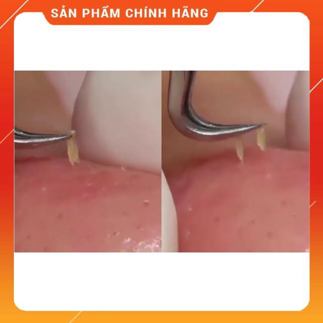 Nhíp Gắp Mụn Không gỉ Hàng Việt Nam