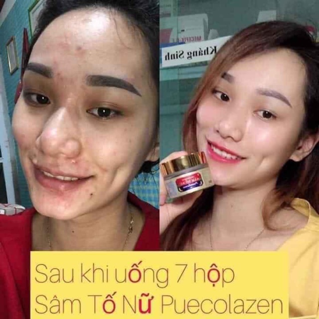 👉 mừng shop khai trương giảm giá trong 7 ngày đầu. SÂM TỐ NỮ  chống giả 100%.