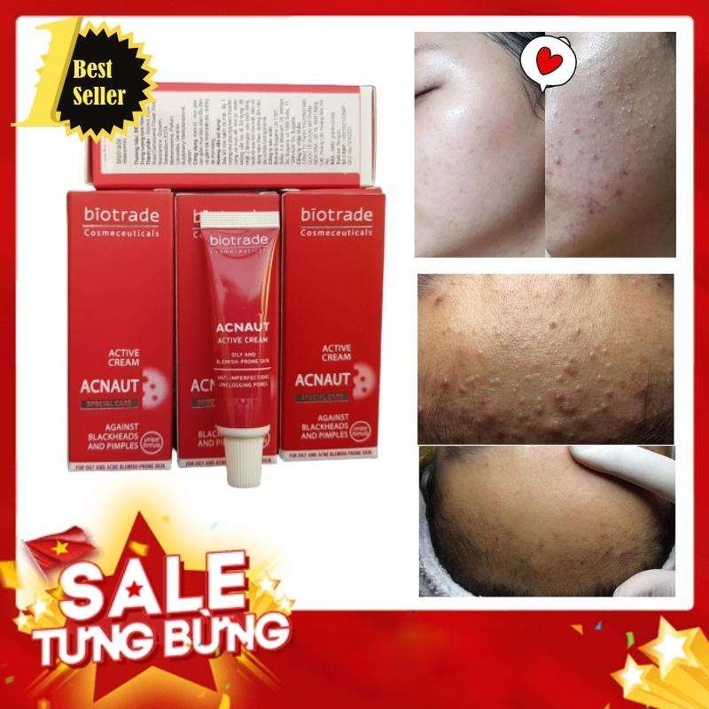 Kem chấm mụn Biotrade Acnaut Active Cream Mini size 5ml