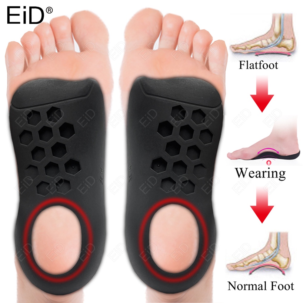 Xo-legs Miếng Lót Giày Định Hình Bàn Chân Phẳng Chữ O Hỗ Trợ Giảm Đau Nẻ Khớp Cỡ Lớn Unisex