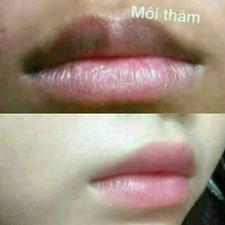Son ủ môi