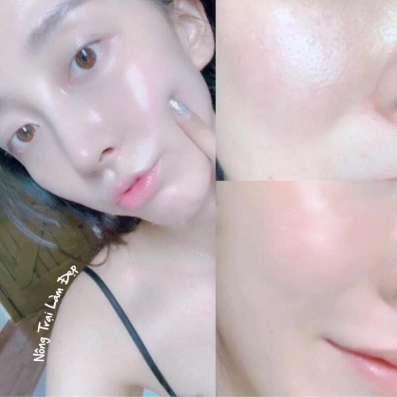 Collagen Lựu kết hợp Bổ sung lợi khuẩn giúp đẹp da, hồng hào, đào thải độc tố