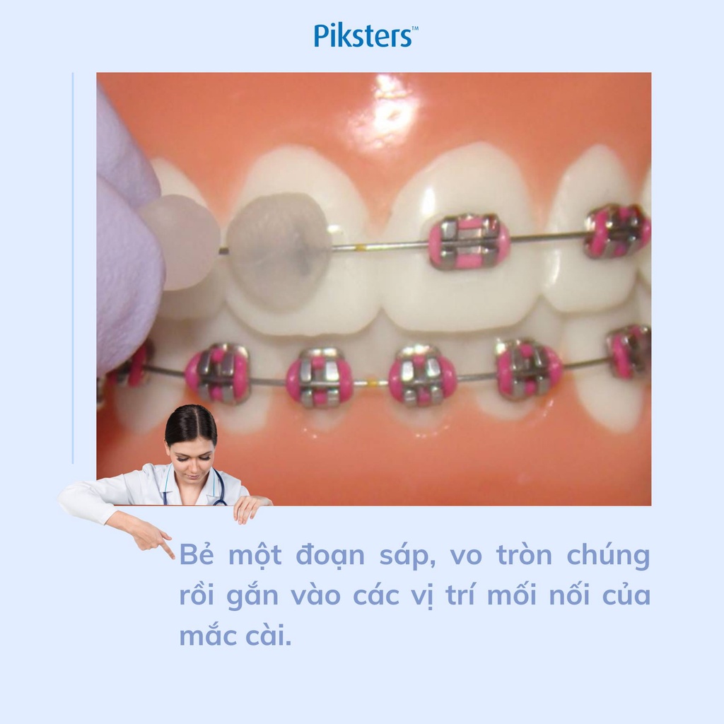 Sáp Chỉnh Nha Piksters SDDS- Bảo vệ răng nướu cho mắc cài sứ, kim loại...giúp giảm cọ sát, tránh tổn thương