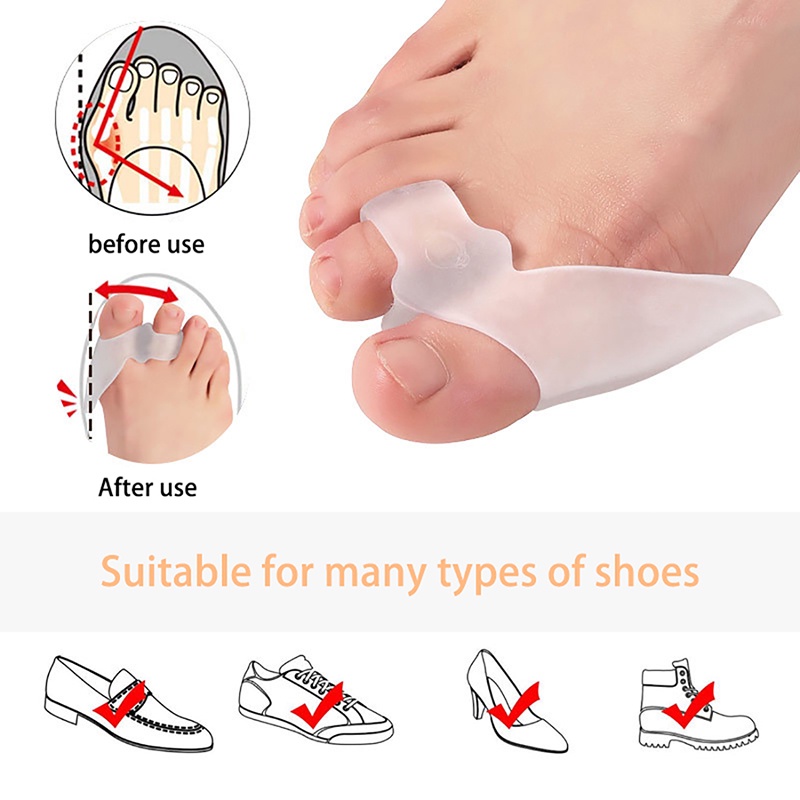 Dụng Cụ Tách Ngón Chân Chỉnh Hình Tiện Dụng Cho Nam Và Nữ