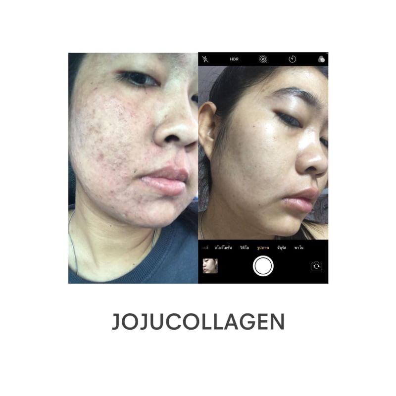 Viên uống Joju collagen 1 hũ 30 viên.