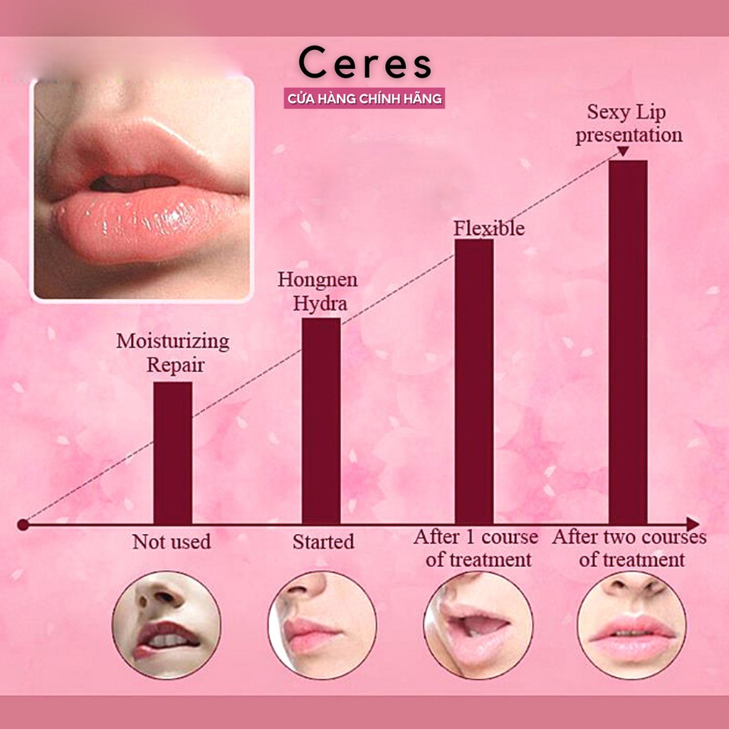 Mặt Nạ Dưỡng Môi - Lip Mask Collagen Images | BigBuy360 - bigbuy360.vn