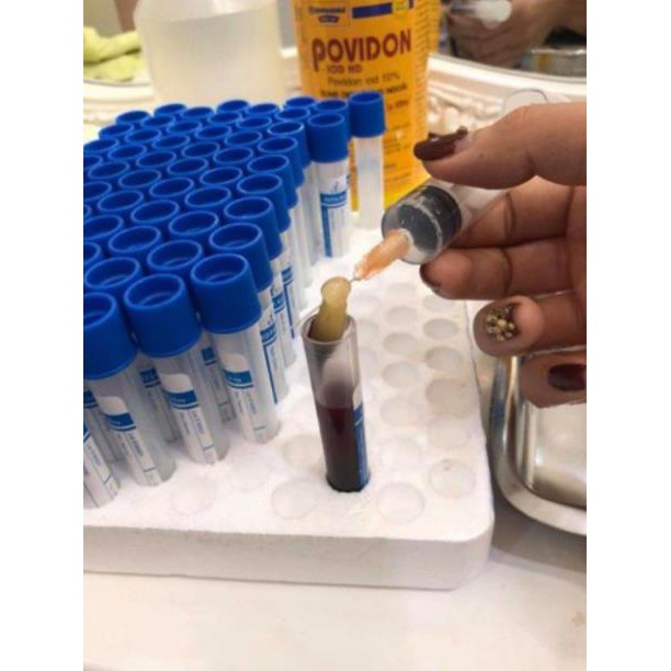 100 ống nghiệm chống đông máu EDTA