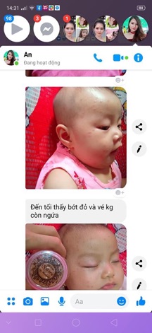 Mỡ trăn đa công dụng N'store