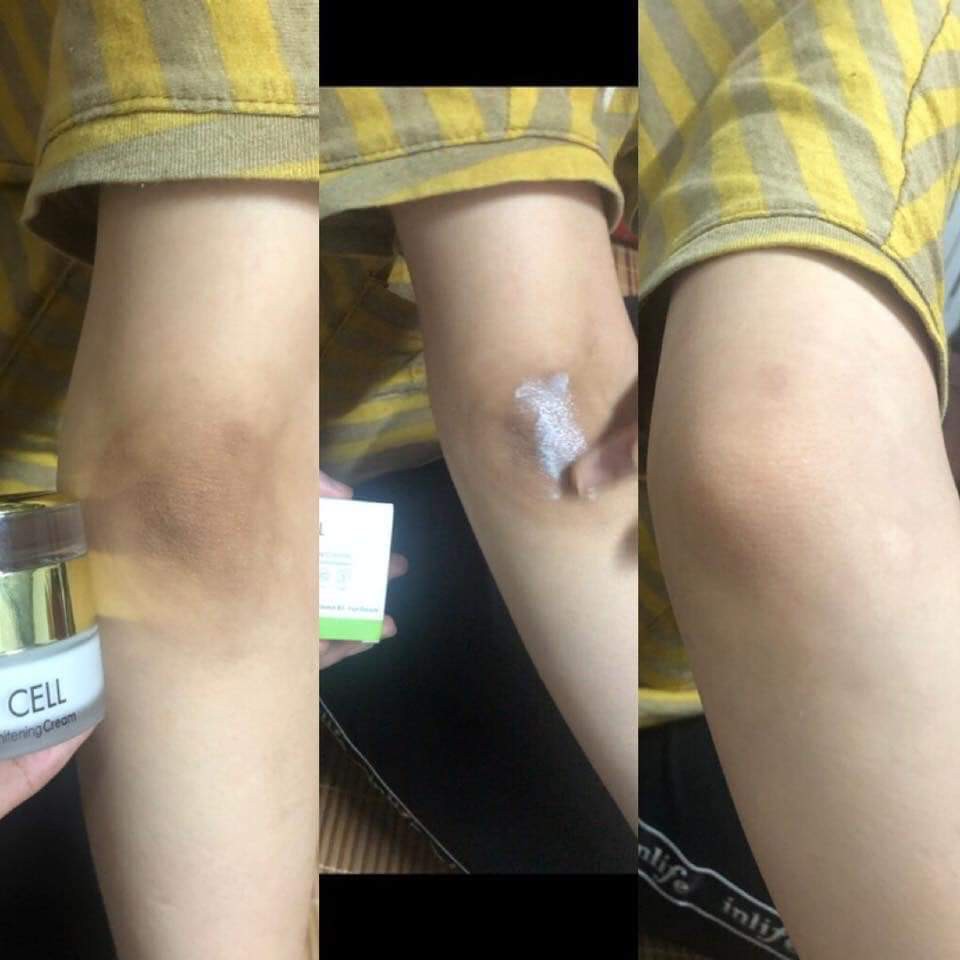 Kem thâm nách ol cell ( cam kết chuẩn 100%, chỉ bán loại 1) | BigBuy360 - bigbuy360.vn