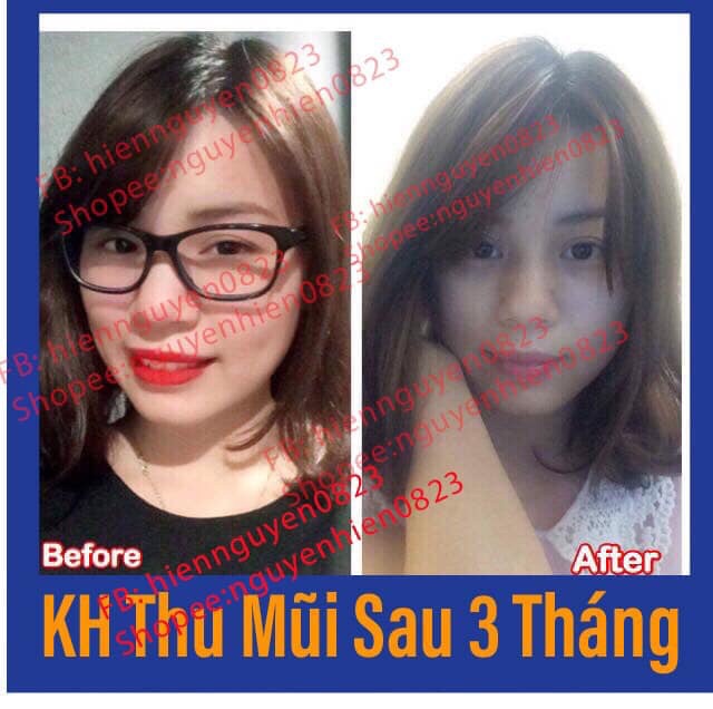 Tinh Chất Thu Nhỏ Mũi Pháp | BigBuy360 - bigbuy360.vn