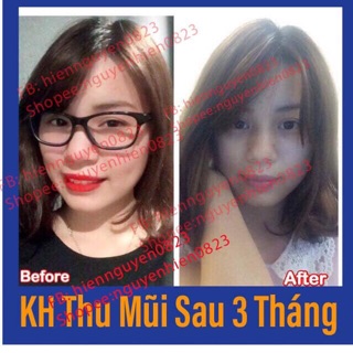 Tinh Chất Thu Nhỏ Mũi Pháp