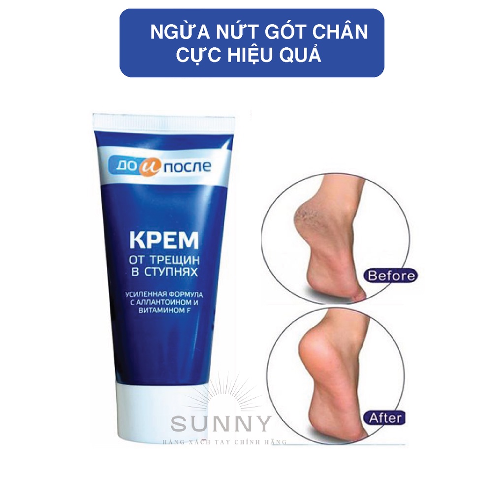 Kem dưỡng da chân Kpem Nga 50ml ngăn ngừa và phục hồi nứt nẻ cho gót chân