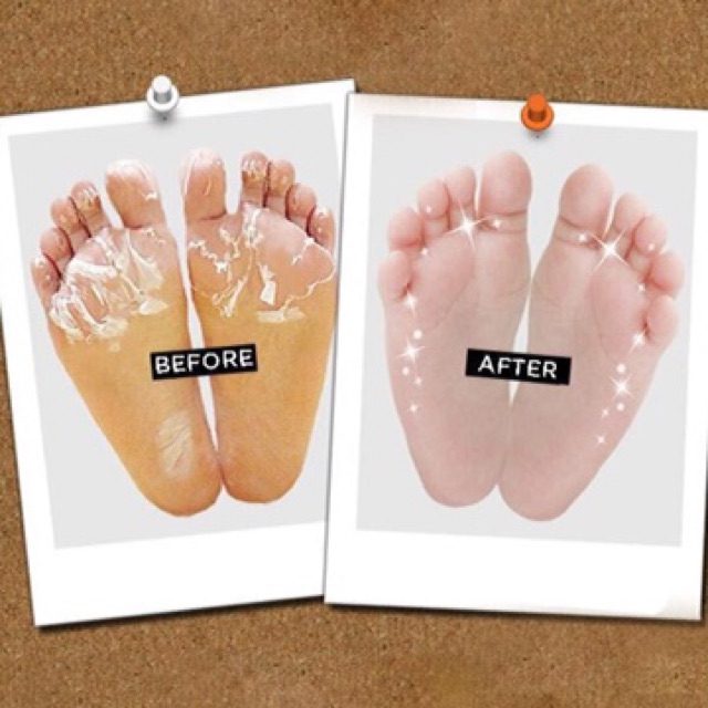 Túi Ủ Lột Da Chân Foot Peeling Korea