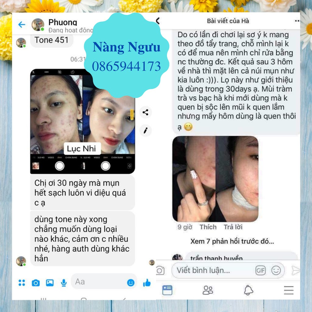Nước Hoa Hồng Ngăn Ngừa Mụn Some By Mi AHA-BHA-PHA 30 Days - Toner Dưỡng Ẩm Kiềm Dầu Cho Da Dầu Mụn 150ml Số 1 Hàn Quốc | BigBuy360 - bigbuy360.vn