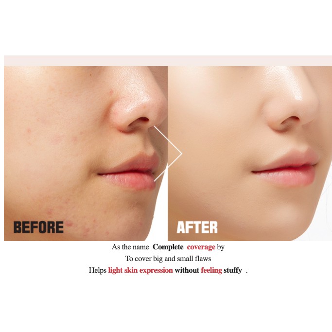 MBC Phấn nước Apieu Wonder Tension Pact các dòng:Perfect Cover/Posong/Madecassoside | BigBuy360 - bigbuy360.vn