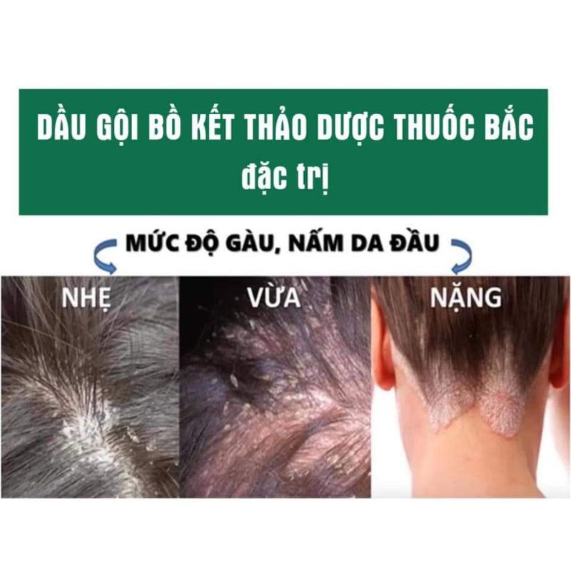 DẦU GỘI THẢO DƯỢC