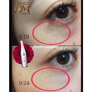Collagen đẹp da Refa 16