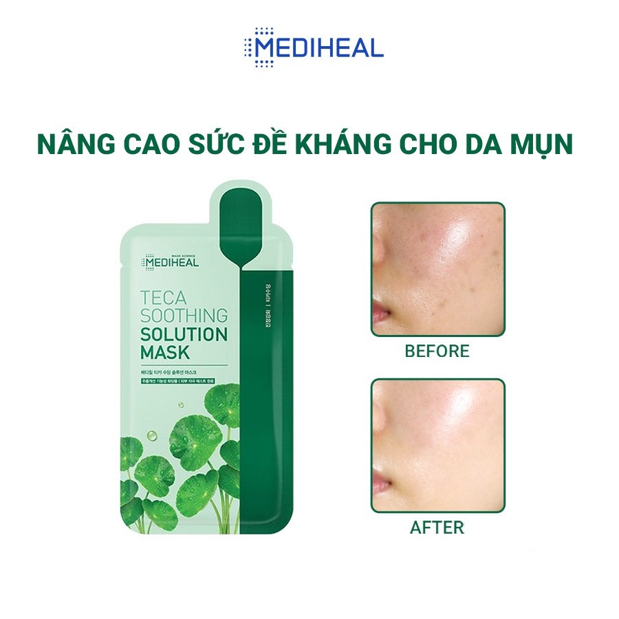 Combo 10 Mặt Nạ Chuyên Sâu Cao Cấp Dành Cho Da Mụn Mediheal Solution Mask 21ml x 10 - Teca Soothing