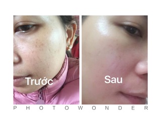 Collagen plus vit E