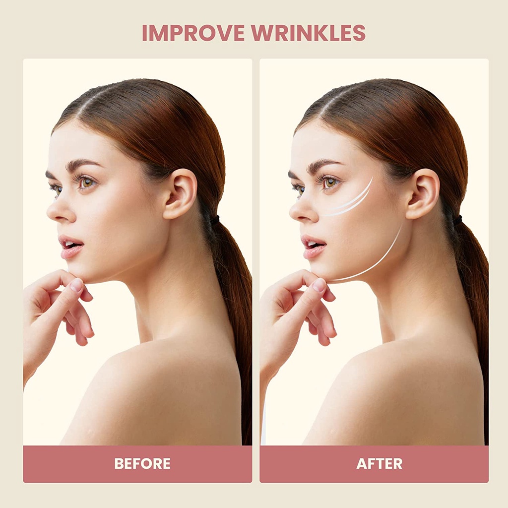 Băng Đô Co Giãn Tùy Chỉnh Giúp Làm Thon Gọn Khuôn Mặt Có Kẹp Tái Sử Dụng