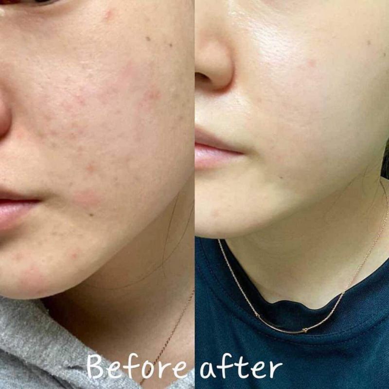 SERUM DƯỠNG TRẮNG NIACINAMIDE 20% LUMIDERM