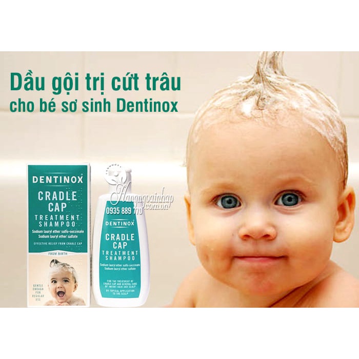 Dầu Gội Cứt Trâu Dentinox, Dầu V.i.ê.m Da Tiết Bã Cho Bé 125ml  Hàng Chính Hãng UK