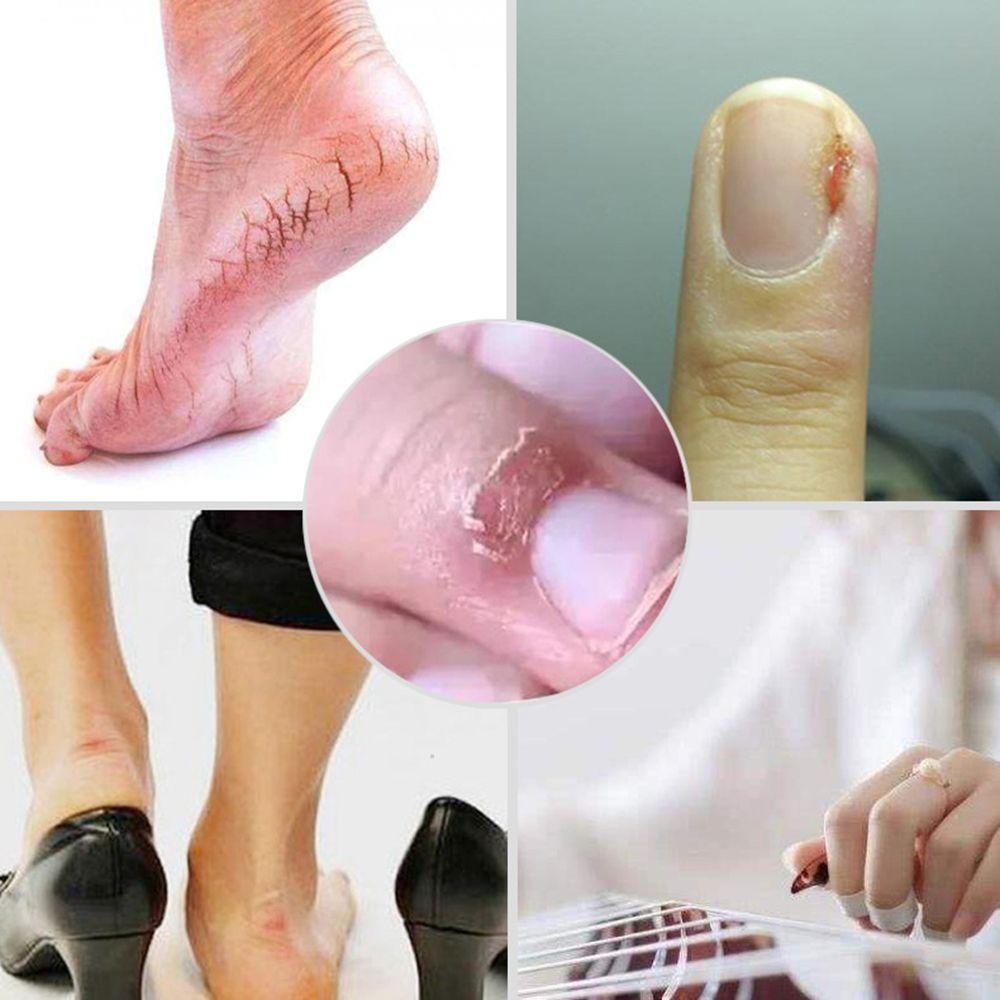 Băng Dán Tự Dính Bằng Cotton Trắng Thoáng Khí Chăm Sóc Sức Khỏe Cho Cổ Tay / Mắt Cá Chân