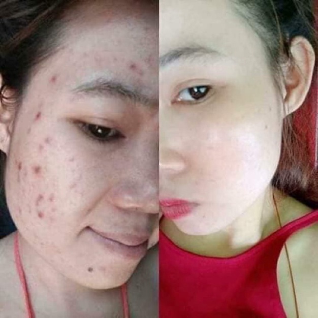 Bộ Kem Dưỡng Da Mặt Vip White tặng kèm serum Vipwhite Hàng CHính Hãng VIP WHITE