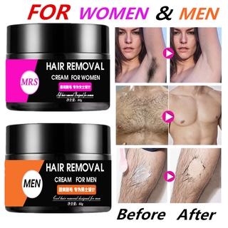 Kem Tẩy Lông Không Đau Dành Cho Nam Và Nữ