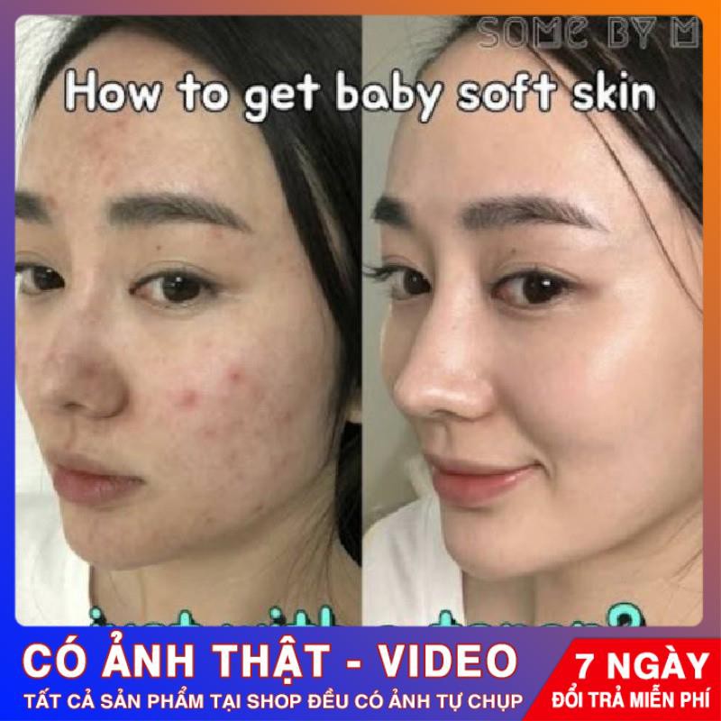 [CHÍNH HÃNG] Nước Hoa Hồng Giảm Mụn Some By Mi AHA-BHA-PHA 30 Days Miracle Toner Some By Me 150ml | BigBuy360 - bigbuy360.vn