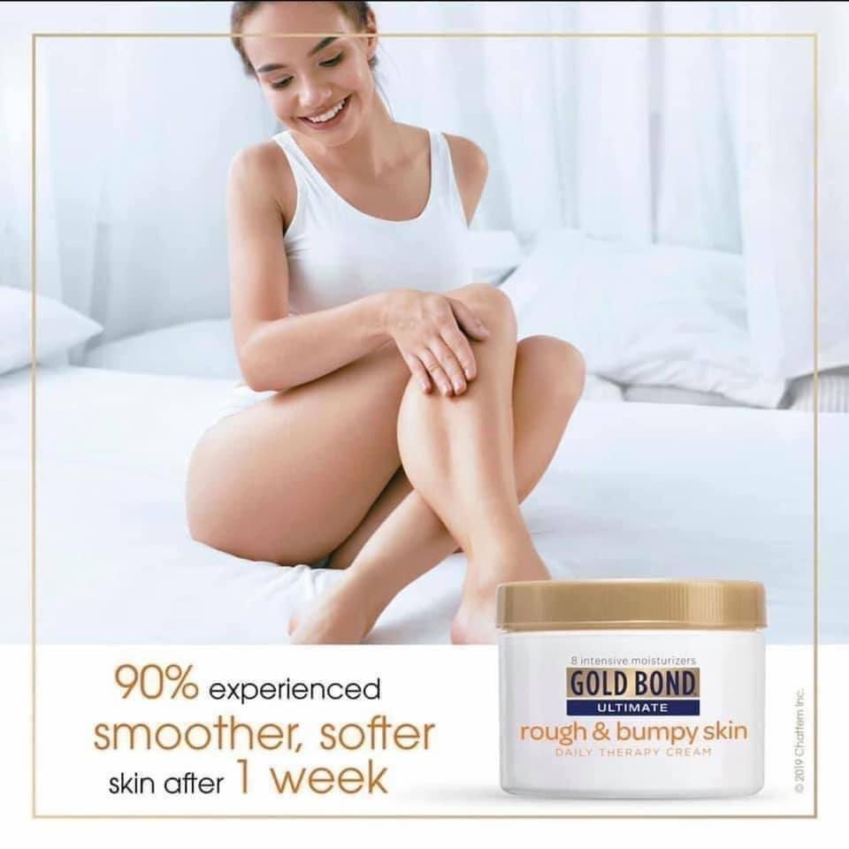 Kem dưỡng Body Gold Bond Rough and Bumpy Skin 226gr | BigBuy360 - bigbuy360.vn