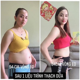 [CHÍNH HÃNG] Thạch dứa giảm cân Hydro Pinapple Burn - Matxi Corp