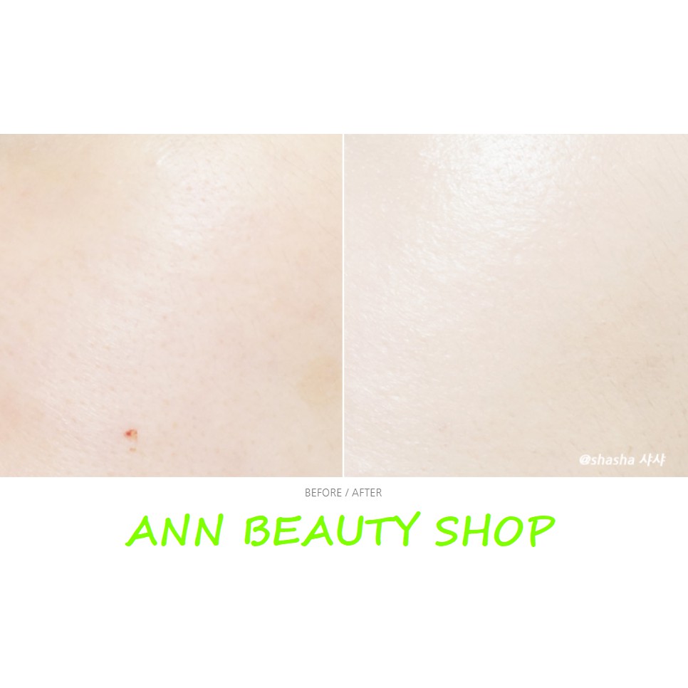 [TÁCH SET]Phấn Tươi Age 20’s Essence Cover Pact Special Set (date 9/2021) | BigBuy360 - bigbuy360.vn