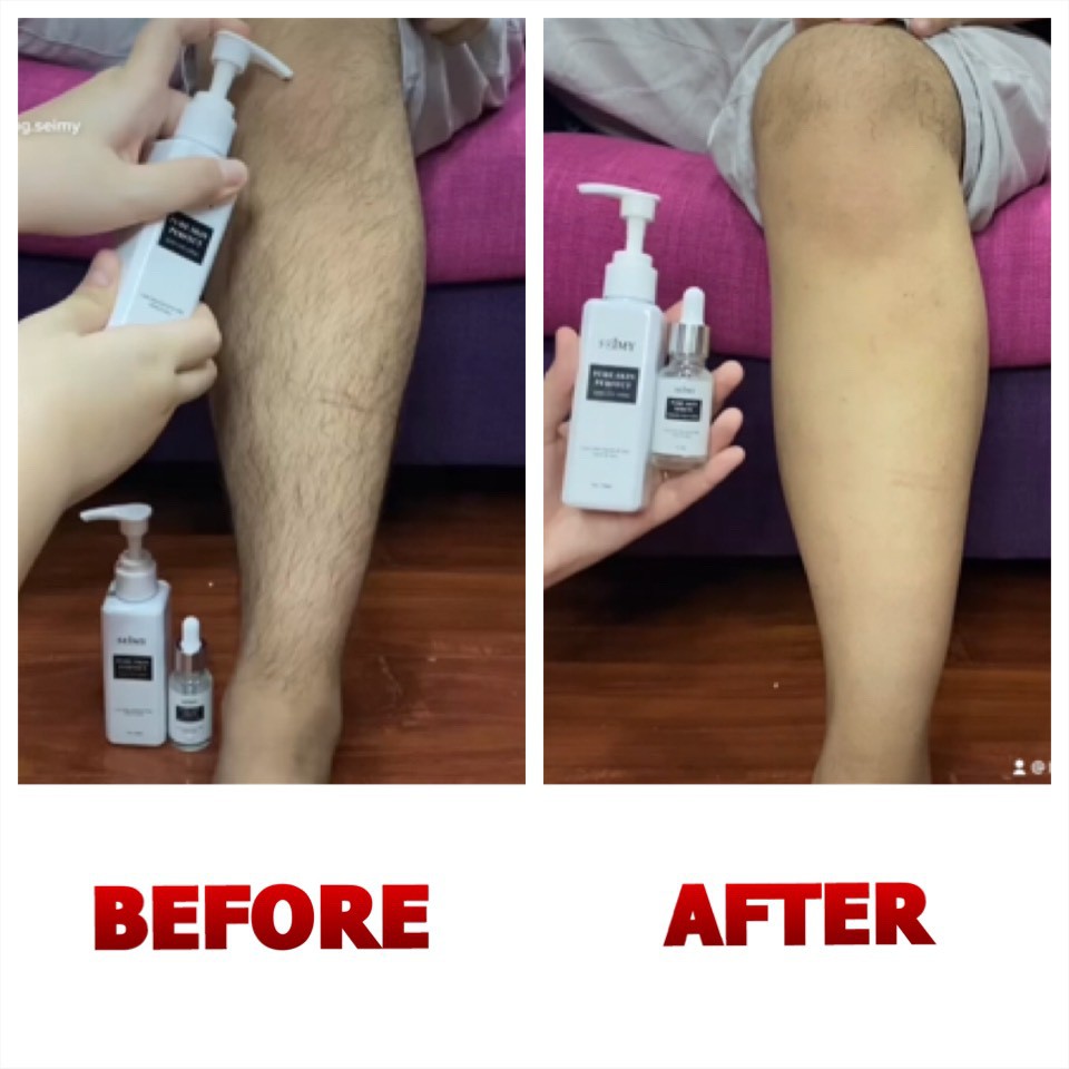 Combo Kem Tẩy Lông Seimy - Pure Skin Perfect triệt sạch bất chấp mọi loại lông vĩnh viễn nhanh gọn chỉ 5 phút