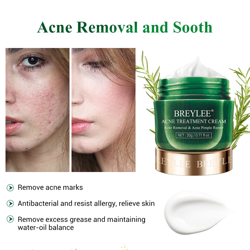 Serum hỗ trợ giảm Mụn BREYLEE 17ML+Kem hỗ trợ giảm Mụn Breylee 20g