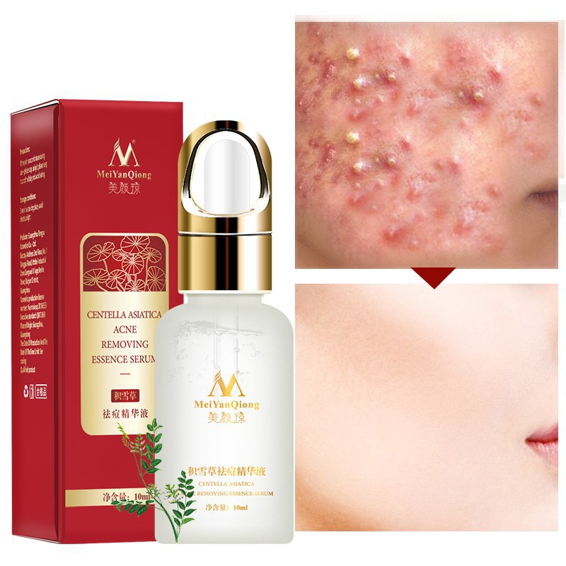 Centella Asiatica Essence Hydrating Control Oil Face Skin Care | BigBuy360 - bigbuy360.vn