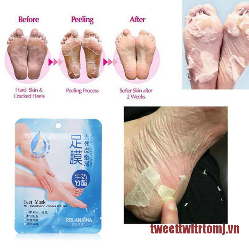 TOMJ 1 Pair Exfoliating Foot Masks Peeling Mask Remove Feet Dead Skin Calluses