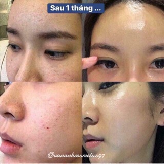 Tẩy da chết The Ordinary Peeling AHA 30% + BHA 2%