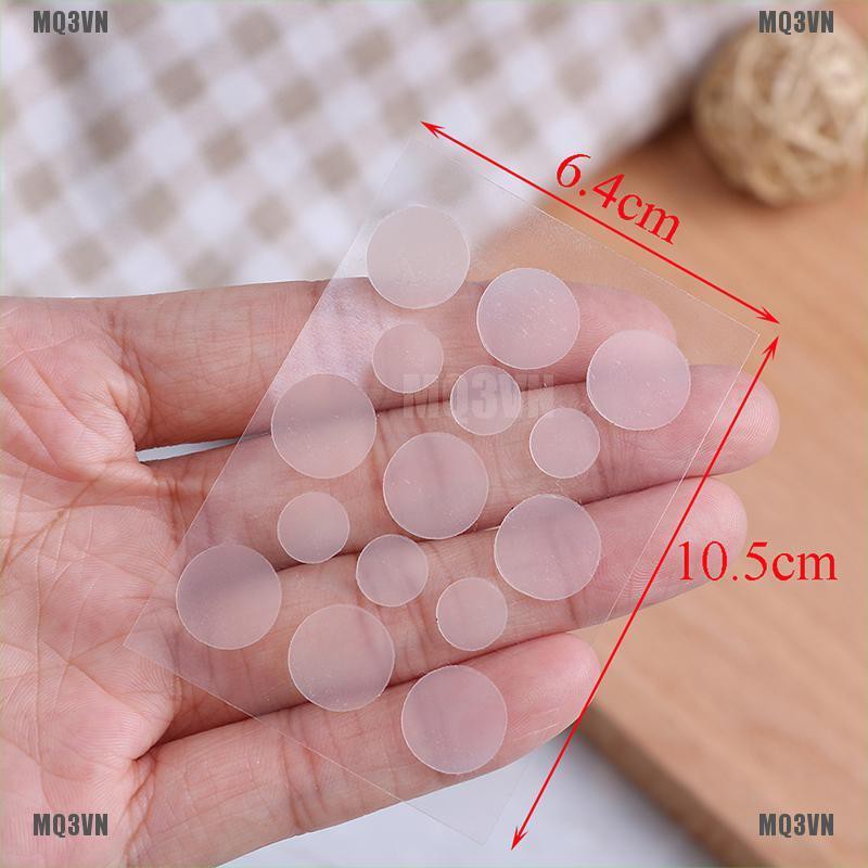 Set 15 miếng dán che sẹo khi nặn mụn tiện dụng | BigBuy360 - bigbuy360.vn