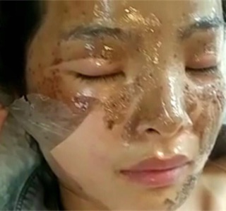 Mặt Nạ Màng Tế Bào Gốc