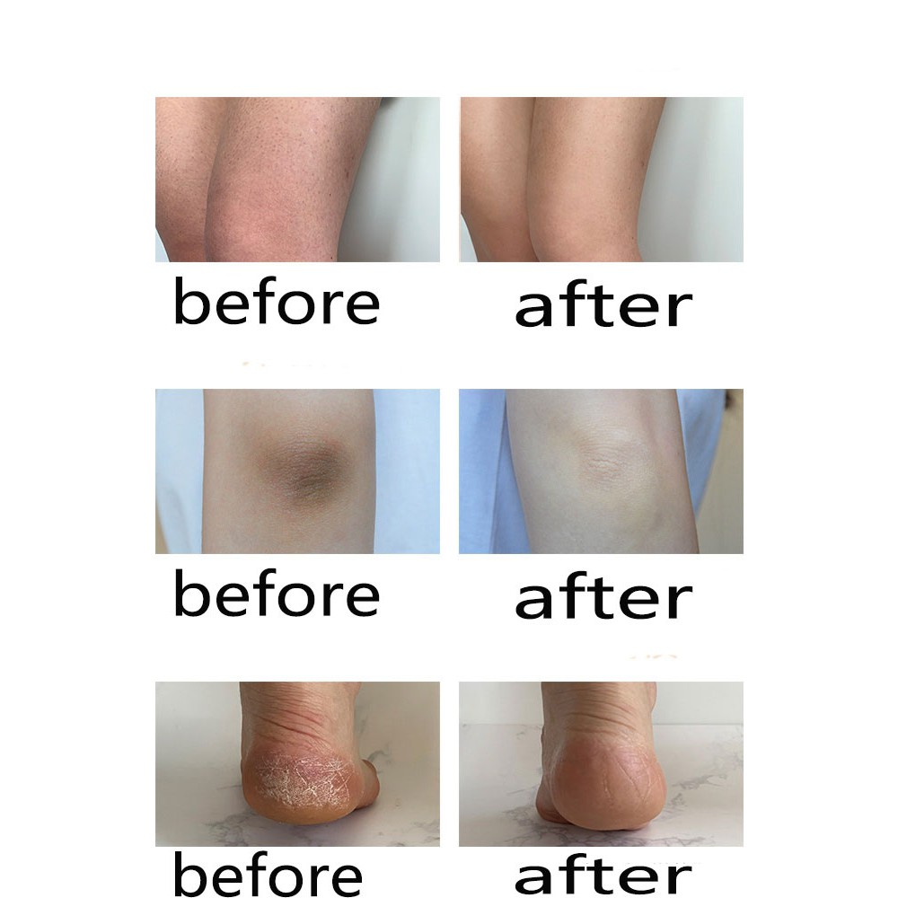 Kem Tắm Tẩy Tế Bào Chết Làm Mềm Da RNW Toàn Thân Giúp Da Trắng Sáng Mịn Màng 250g