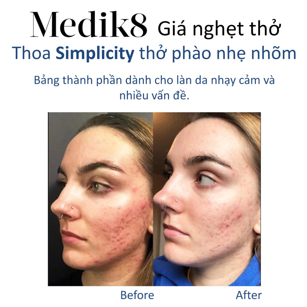 Tinh chất Vitamin B5 dupe Medik8 dịu da siêu cấp ẩm da mụn da nhạy cảm