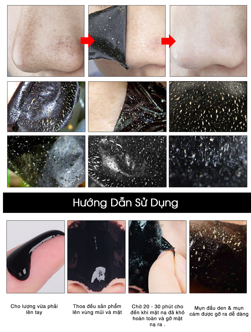 [Hàng Có Sẵn] LANBENA Chai Gel Lột Mụn Mũi, Mụn Cám & Mụn Đầu Đen 50g | BigBuy360 - bigbuy360.vn